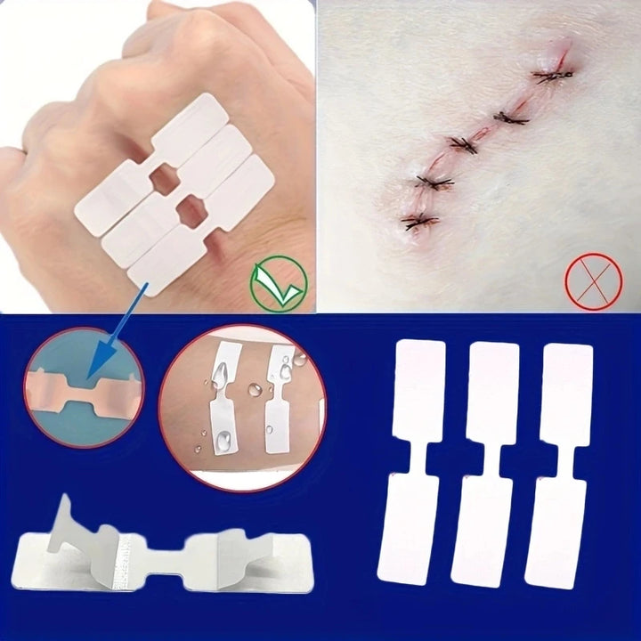5Pcs Disposable First Aid Wound Suture Patch