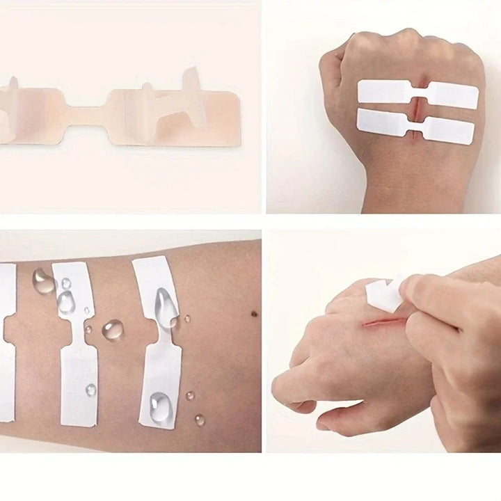 5Pcs Disposable First Aid Wound Suture Patch
