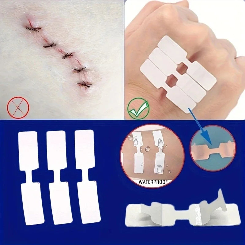 5Pcs Disposable First Aid Wound Suture Patch